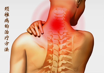 颈椎病