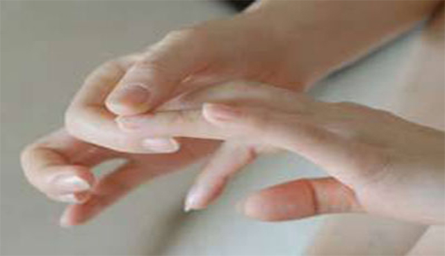 产后风湿性关节炎治疗